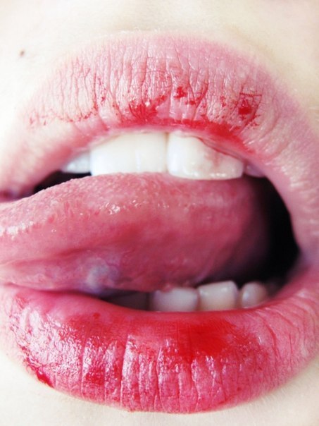 Почему вы кусаете губы и как избавиться от этой опасной привычки